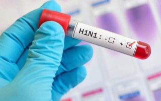 علائم آنفولانزا h1n1
