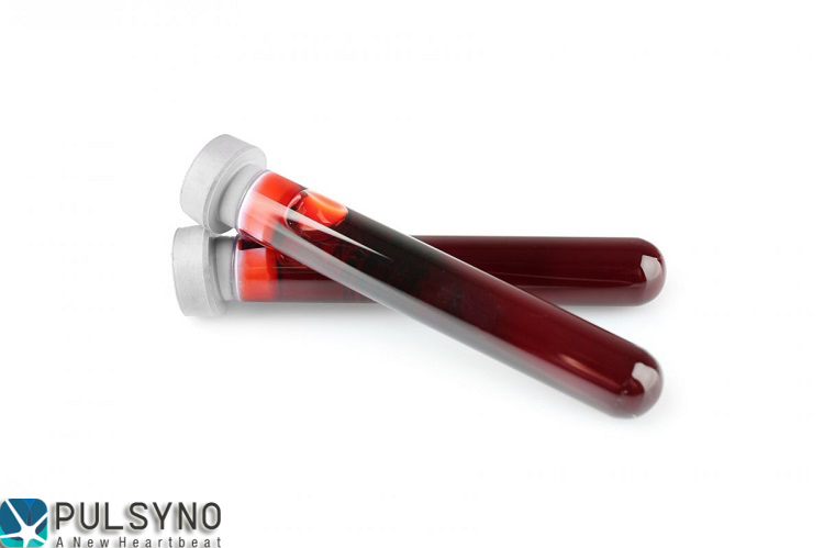 چرا باید آزمایش خون بدهیم