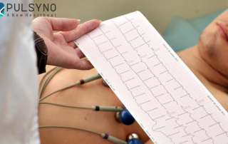 تست نوار قلب یا الکتروکاردیوگرام چیست